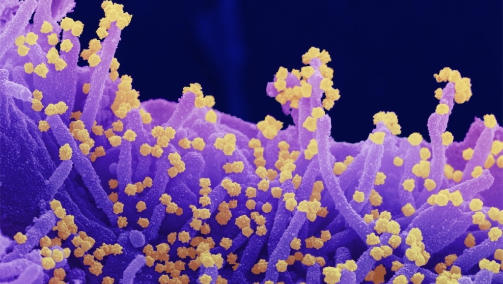 coronavirus lab image