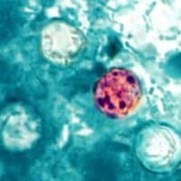 magnified Cyclospora